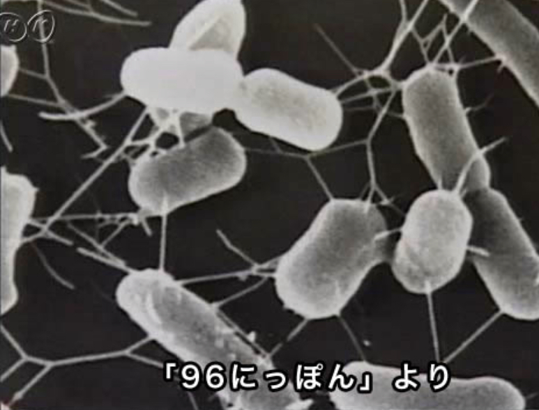 O-157集団食中毒発生